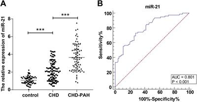 Variation and significance of serum microRNA-21 level in pediatric pulmonary artery hypertension associated with congenital heart disease